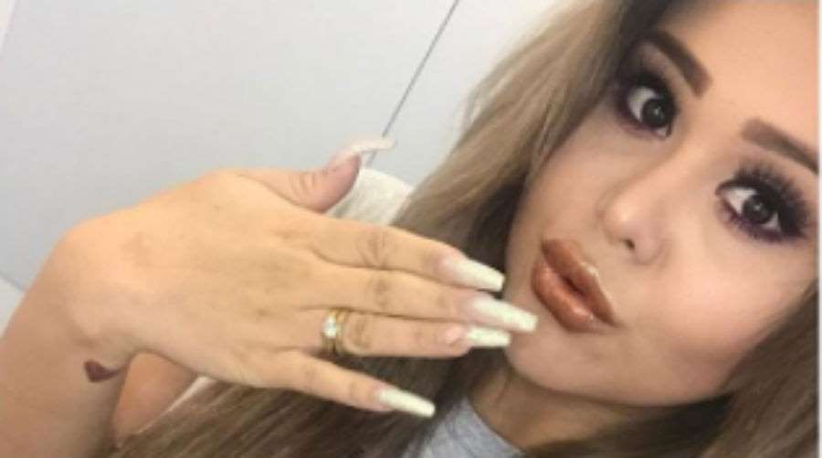 Gomita se opera la nariz y su excirujano explota en su contra