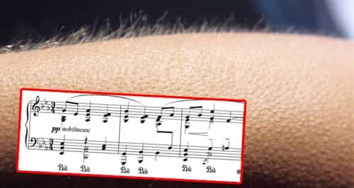 If music gives you goosebumps, your brain might be special