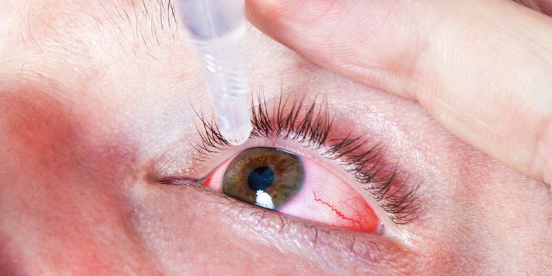 Adiós a las gafas: Estas gotas podrían curar la miopía y otros problemas de visión